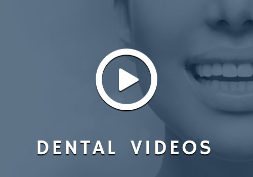 Dental Videos