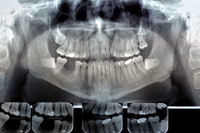 Radiography